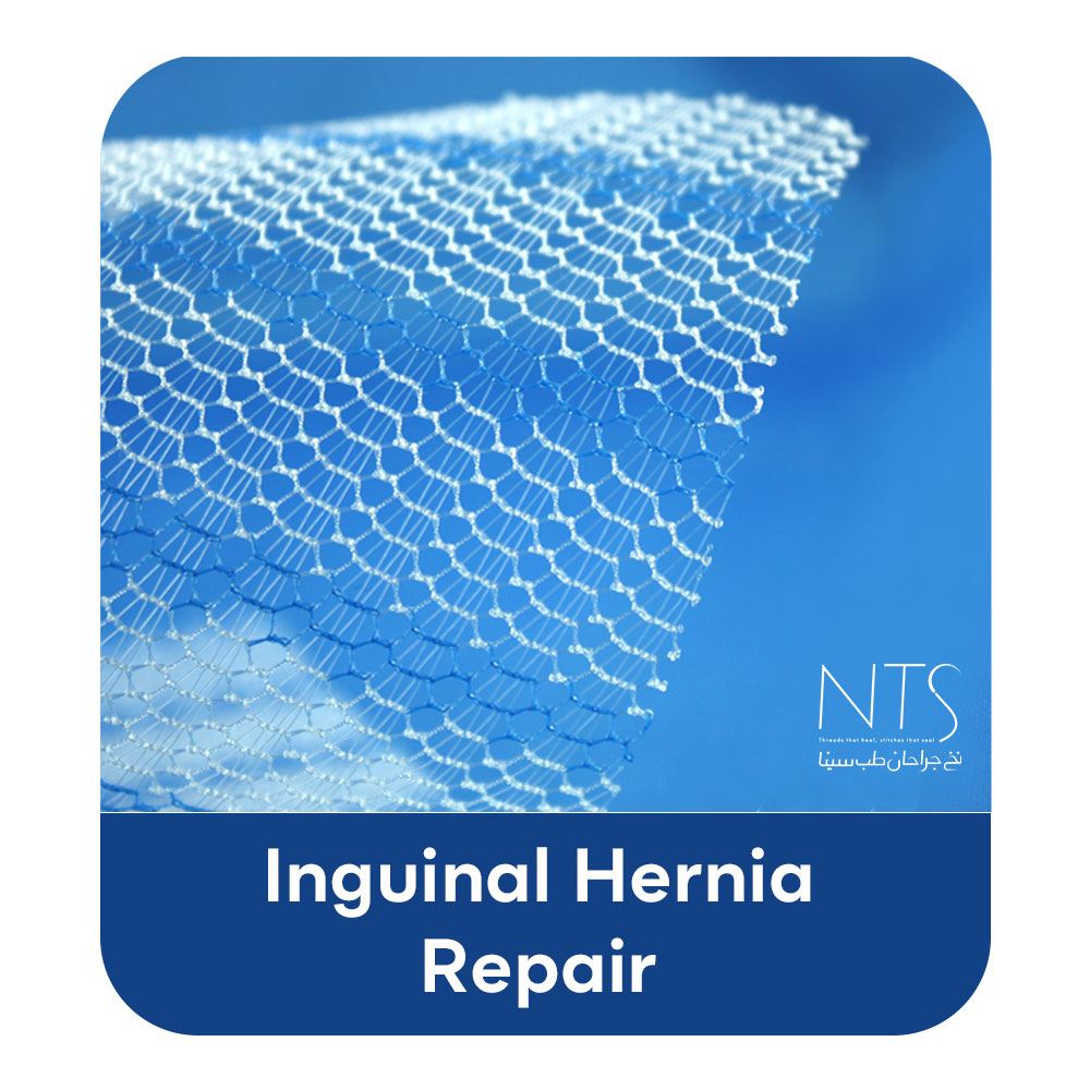 مش جراحیPolypropylene surgical mesh
