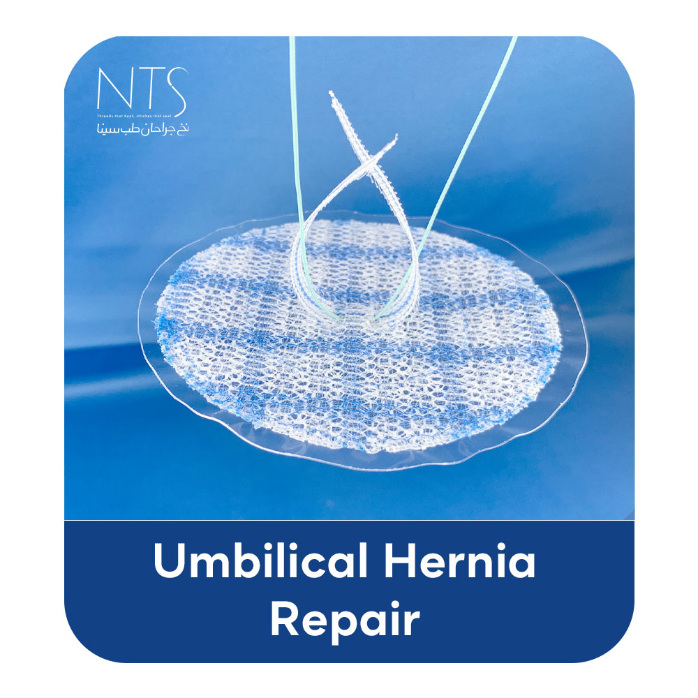 مش جراحی Umbilical Hernia Repair
